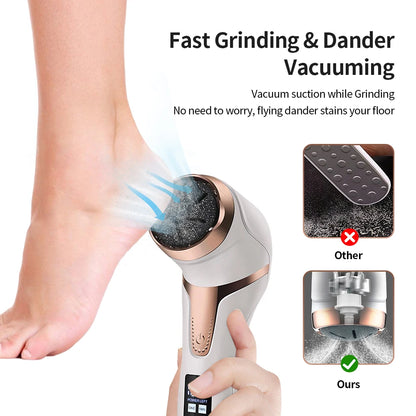 Electronic Foot Files Portable Electric Foot Callus Remover Foot Care Tool for Dead Hard Skin Rechargeable Pedicure Tools